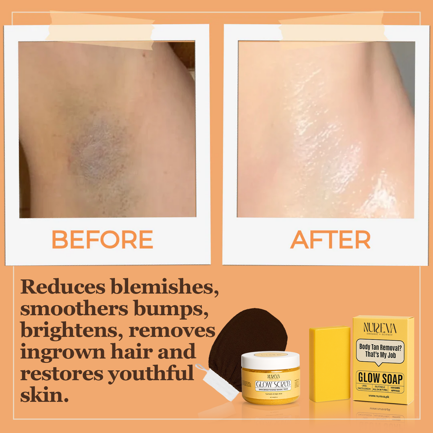 Super Discount Bundle 1