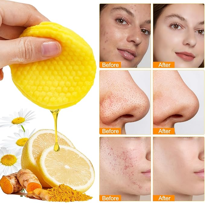 Turmeric & Kojic Acid Cleansing Pads (40 Pads)