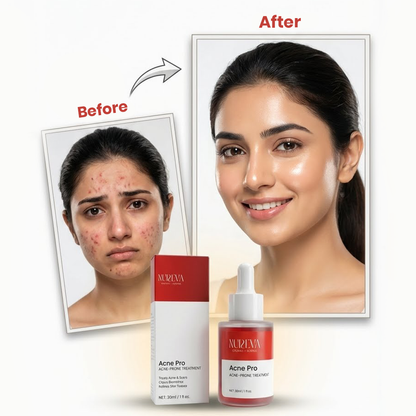 Acne Pro Serum