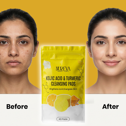 Kojic Acid & Turmeric Cleansing Pads (40 Pads)