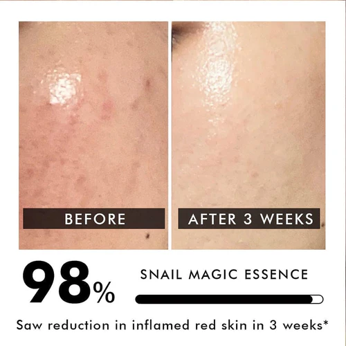 Advanced Snail Mucin Power Essence