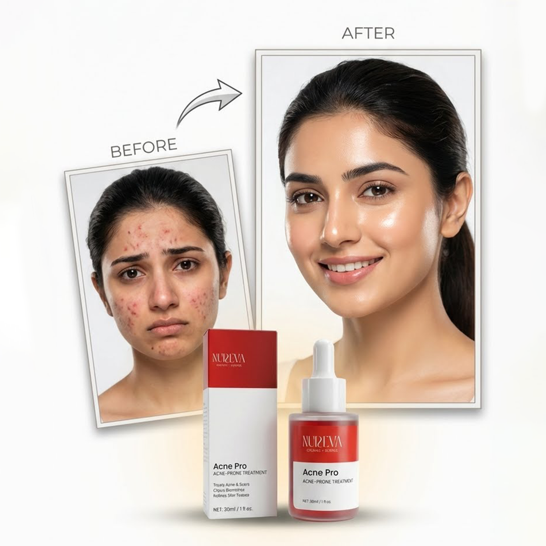 Acne Pro Serum
