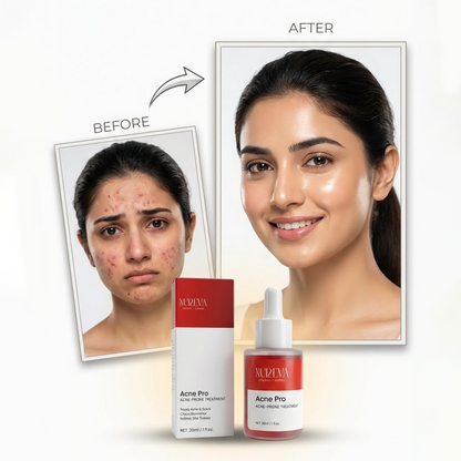 Acne Pro Serum